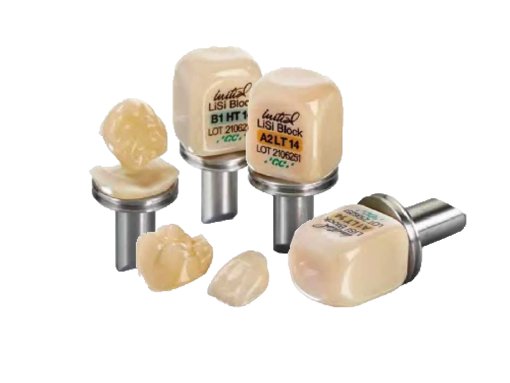 セラミック治療のイメージ画像