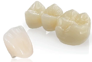 Ceramic_artificial_teeth