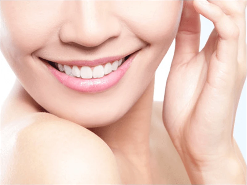 セラミック治療