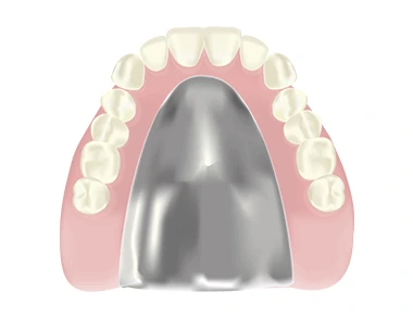 ireba-metal_floor_denture