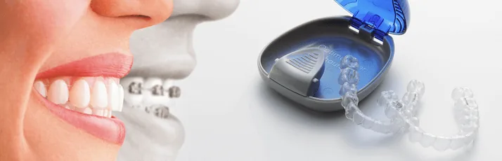 orthodontics-consultation1