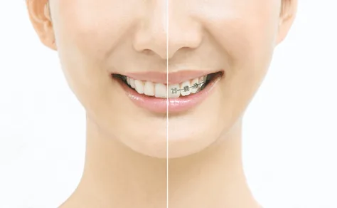 orthodontics-consultation6